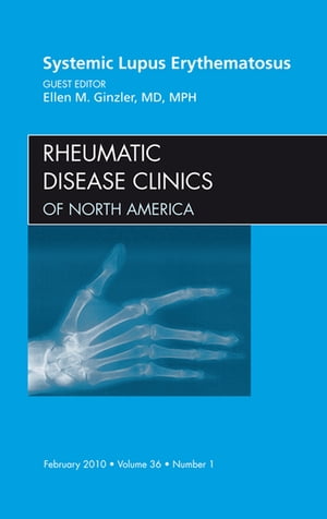 ISBN 9781437718690 Systemic Lupus Erythematosus, an Issue of Rheumatic Disease Clinics: Volume 36-1/SAUNDERS W B CO/Ellen M. Ginzler 本・雑誌・コミック 画像