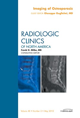 ISBN 9781437719444 Imaging of Osteoporosis, an Issue of Radiologic Clinics of North America: Volume 48-3 /SAUNDERS W B CO/Giuseppe Guglielmi 本・雑誌・コミック 画像