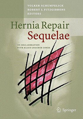 ISBN 9783642045523 Hernia Repair Sequelae/SPRINGER NATURE/Volker Schumpelick 本・雑誌・コミック 画像