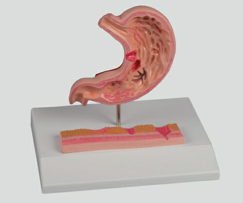 EAN 4250395305389 アズワン 胃潰瘍モデル 120×90×208-8569-01 医薬品・コンタクト・介護 画像